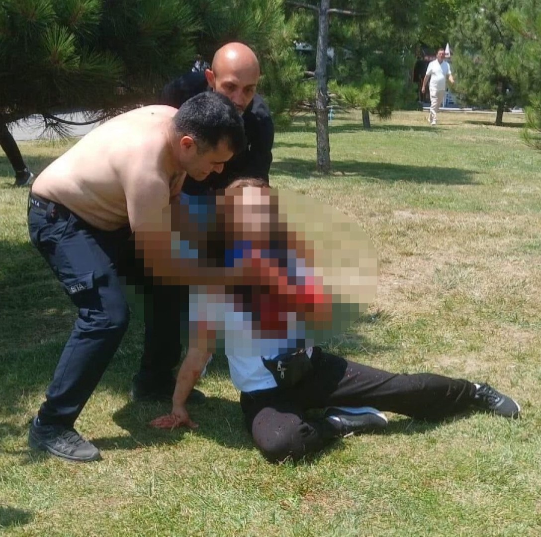 Boşanma aşamasındaki eşini boğazından bıçakladı!
